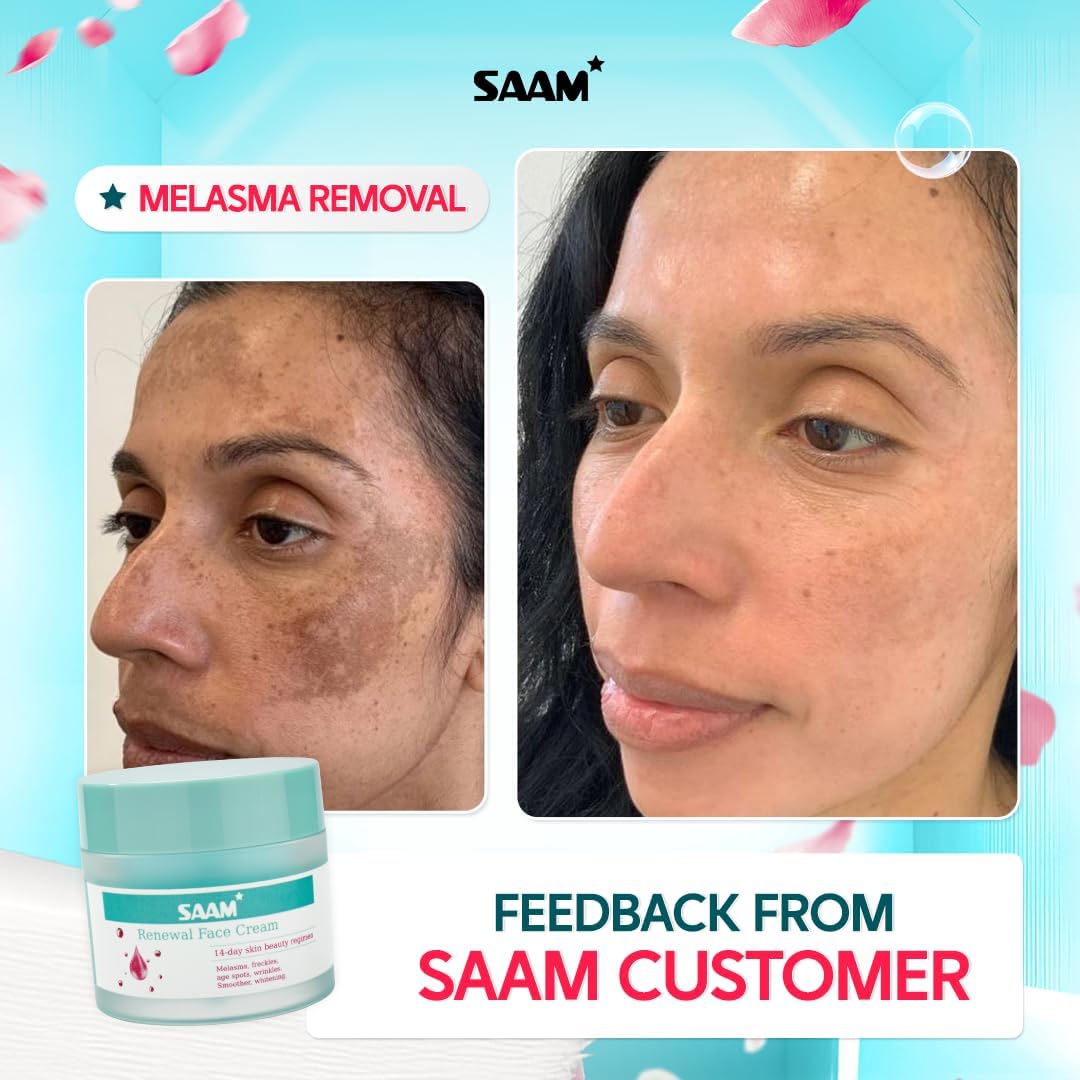 SAAM Renewal Face Cream | Melasma, Freckles, Age Spots & Dark Spots | With Alpha Arbutin and Kojic Acid