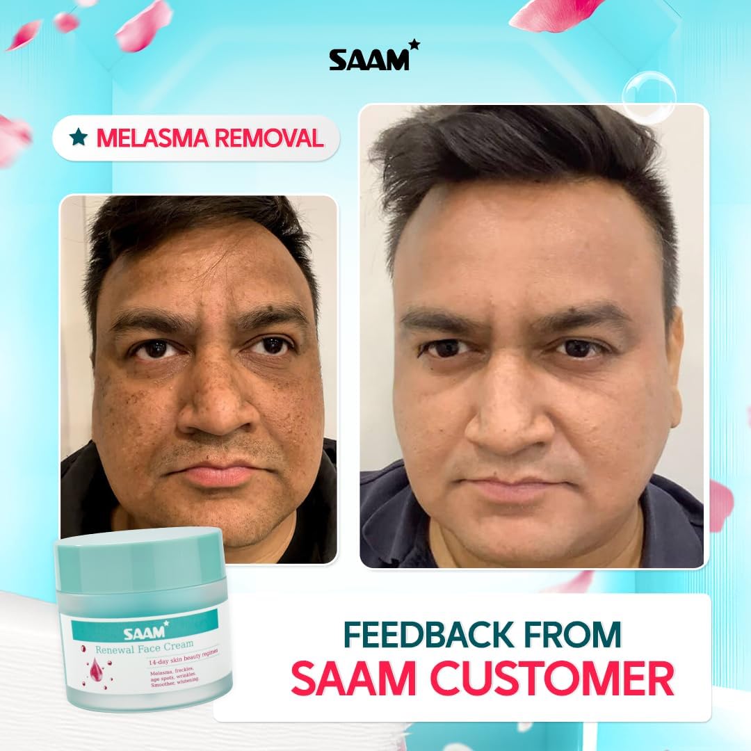 SAAM Renewal Face Cream | Melasma, Freckles, Age Spots & Dark Spots | With Alpha Arbutin and Kojic Acid
