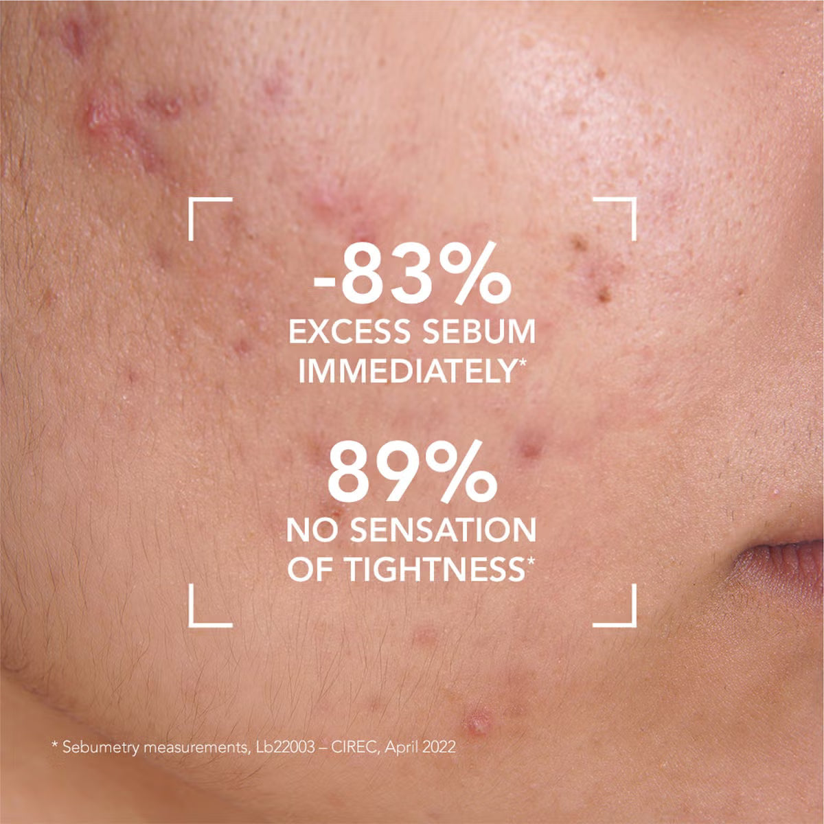 Bioderma Sébium Face Wash – Purifying Cleanser for Oily/Combination Skin